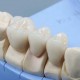 Протезирование зубов: особенности
